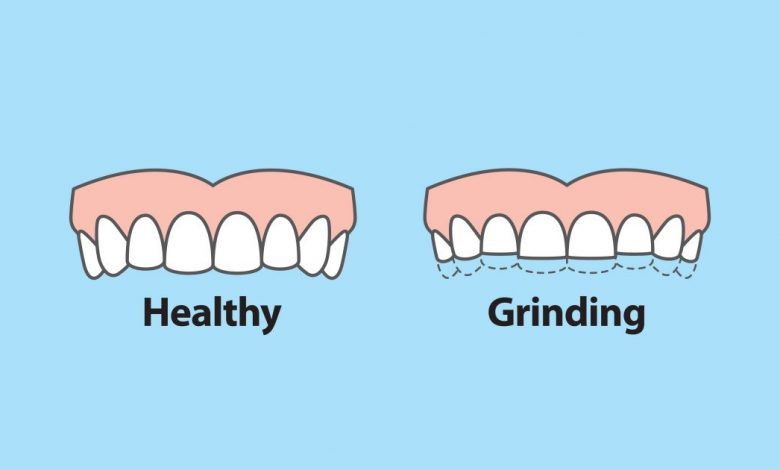 10 children have teeth grinding habits in America