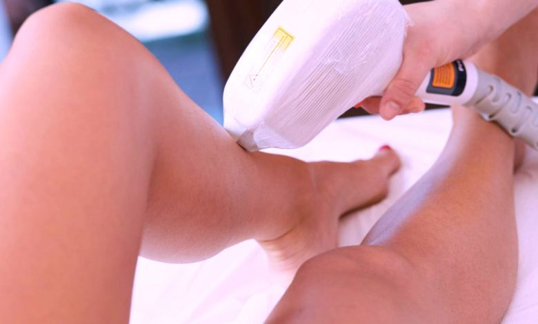 How Does Laser Hair Removal Work?