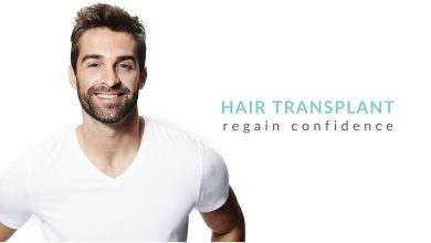 Photo of Important FAQs about Hair Transplantation