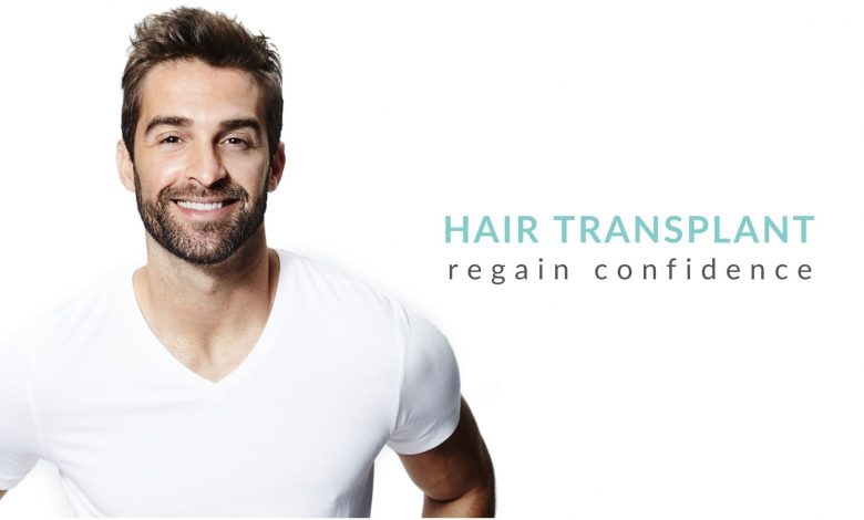 Important FAQs about Hair Transplant