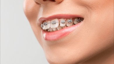 Photo of Invisalign Braces – Perfect Answer For Your Uneven Teeth
