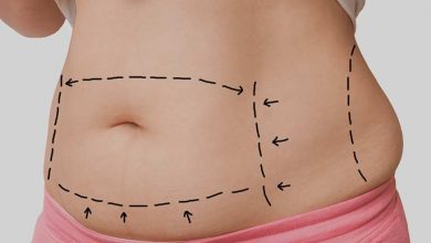 Photo of WHAT CAN A MOMMY MAKEOVER SURGERY DO FOR YOUR BODY REVITALIZATION?