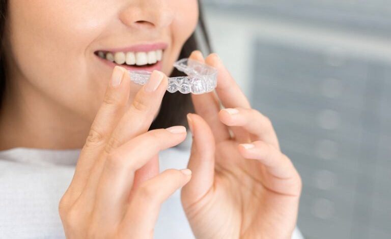 What You Need to Know About Invisalign