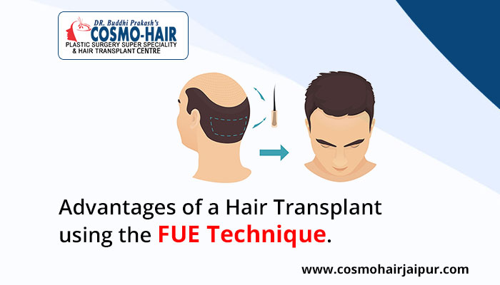 disadvantages and advantages of hair transplant