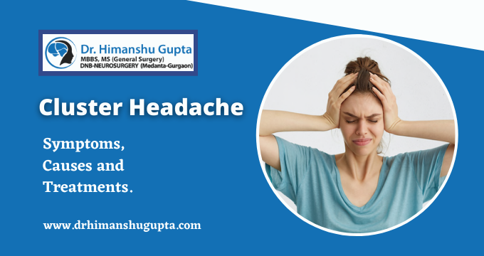 what is a Cluster Headache