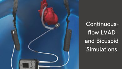 Photo of Insights on the Continuous-flow LVAD and Bicuspid Simulations